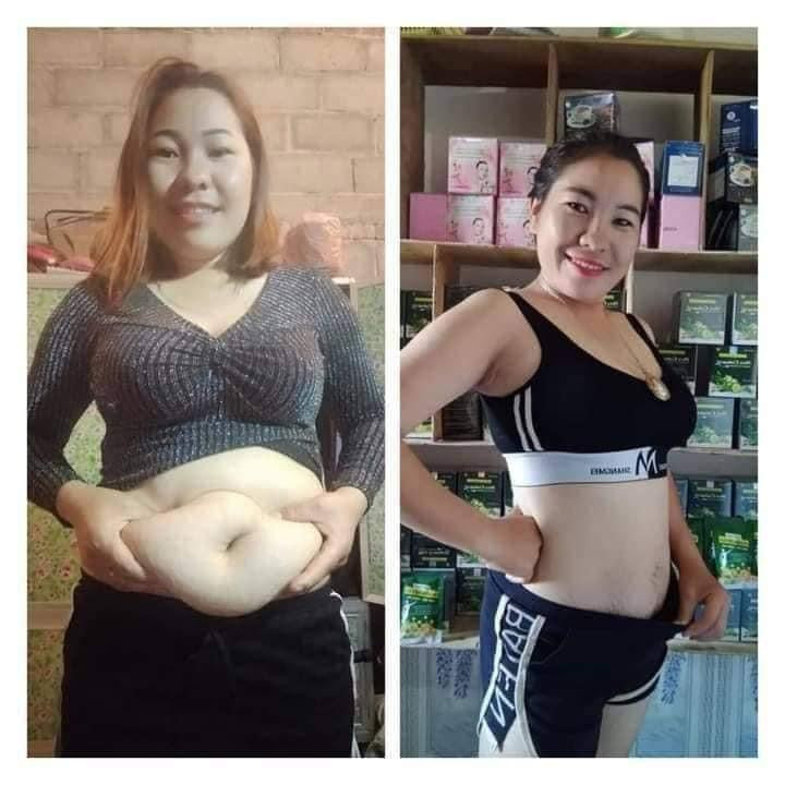 Hot Selling Hoa Collagen Weight Loss Detox